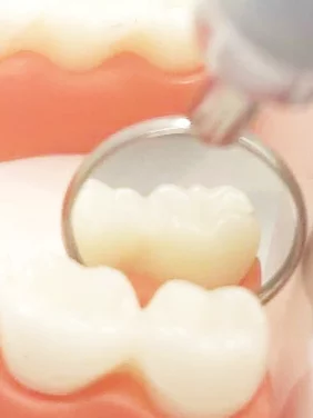 Dental Mirror with Light - Image 4