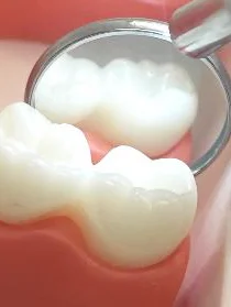 Dental Mirror with Light - Image 5